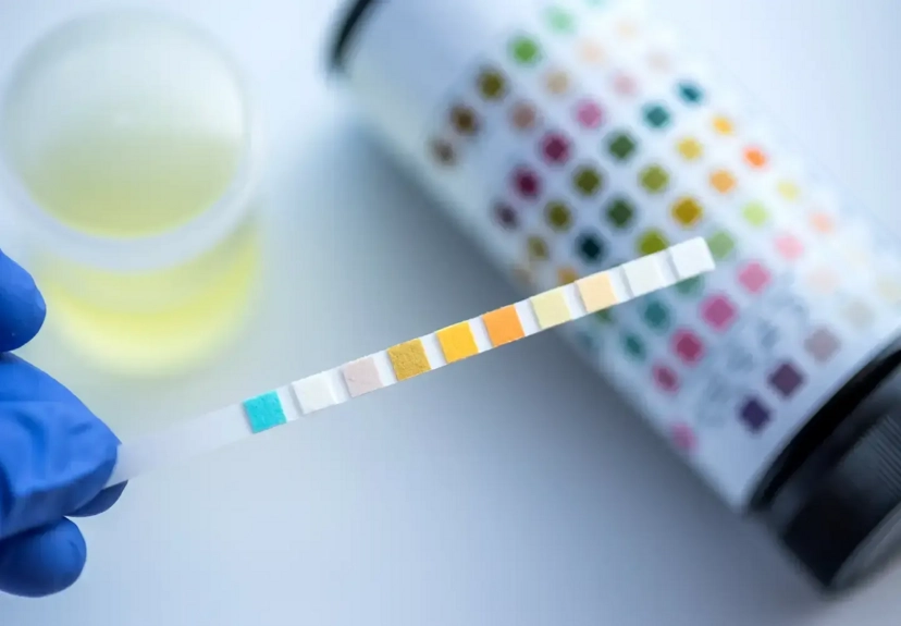 Complete Guide to Pre-Employment Drug Testing Laws