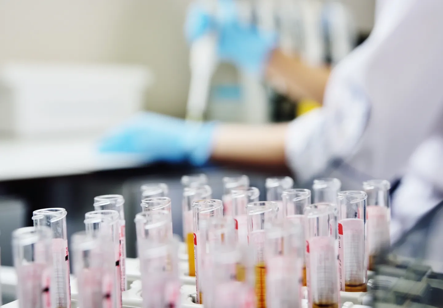 random drug testing test tubes